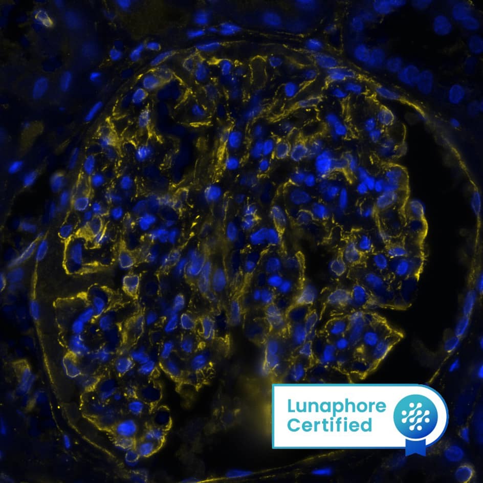 Vimentin was detected in immersion fixed paraffin-embedded sections of human kidney using Mouse Anti-Human/Mouse/Rat Vimentin Monoclonal Antibody (Catalog # MAB21052) at 0.05 µg/mL at 37 ° Celsius for 4 minutes. Before incubation with the primary antibody, tissue underwent an all-in-one dewaxing and antigen retrieval preprocessing using PreTreatment Module (PT Module) and Dewax and HIER Buffer H (pH 9; Epredia Catalog # TA-999-DHBH).Tissue was stained using the Alexa Fluor™ 647 Goat anti-Mouse IgG Secondary Antibody at 1:200 at 37 ° Celsius for 2 minutes. (Yellow; Lunaphore Catalog # DR647MS) and counterstained with DAPI (blue; Lunaphore Catalog # DR100). Specific staining was localized to the cytoplasm and cytoskeleton. Protocol available in COMET™ Panel Builder.