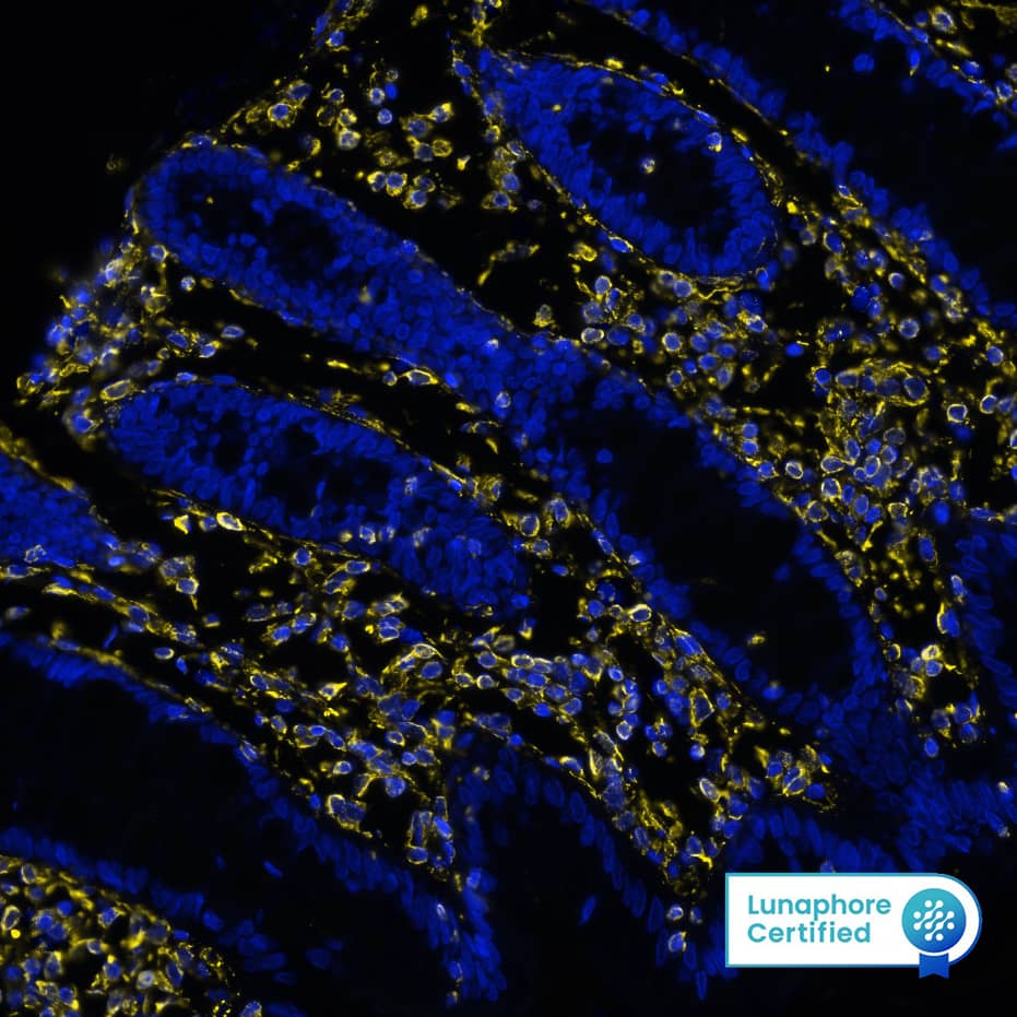 Vimentin was detected in immersion fixed paraffin-embedded sections of human colon using Mouse Anti-Human/Mouse/Rat Vimentin Monoclonal Antibody (Catalog # MAB21052) at 0.05 µg/mL at 37 ° Celsius for 4 minutes. Before incubation with the primary antibody, tissue underwent an all-in-one dewaxing and antigen retrieval preprocessing using PreTreatment Module (PT Module) and Dewax and HIER Buffer H (pH 9; Epredia Catalog # TA-999-DHBH).Tissue was stained using the Alexa Fluor™ 647 Goat anti-Mouse IgG Secondary Antibody at 1:200 at 37 ° Celsius for 2 minutes. (Yellow; Lunaphore Catalog # DR647MS) and counterstained with DAPI (blue; Lunaphore Catalog # DR100). Specific staining was localized to the cytoplasm and cytoskeleton. Protocol available in COMET™ Panel Builder.