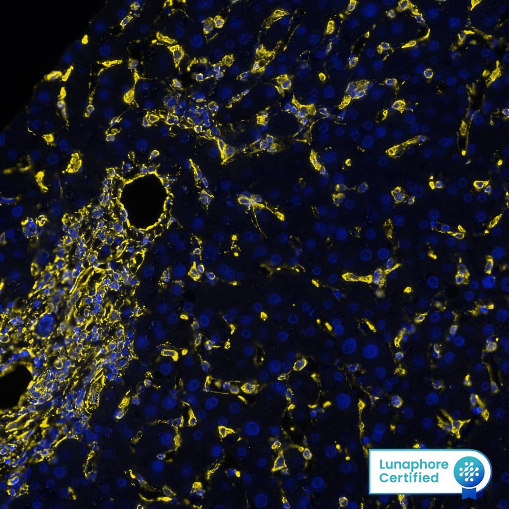 Vimentin was detected in immersion fixed paraffin-embedded sections of human liver using Mouse Anti-Human/Mouse/Rat Vimentin Monoclonal Antibody (Catalog # MAB21052) at 0.05 µg/mL at 37 ° Celsius for 4 minutes. Before incubation with the primary antibody, tissue underwent an all-in-one dewaxing and antigen retrieval preprocessing using PreTreatment Module (PT Module) and Dewax and HIER Buffer H (pH 9; Epredia Catalog # TA-999-DHBH).Tissue was stained using the Alexa Fluor™ 647 Goat anti-Mouse IgG Secondary Antibody at 1:200 at 37 ° Celsius for 2 minutes. (Yellow; Lunaphore Catalog # DR647MS) and counterstained with DAPI (blue; Lunaphore Catalog # DR100). Specific staining was localized to the cytoplasm and cytoskeleton. Protocol available in COMET™ Panel Builder.