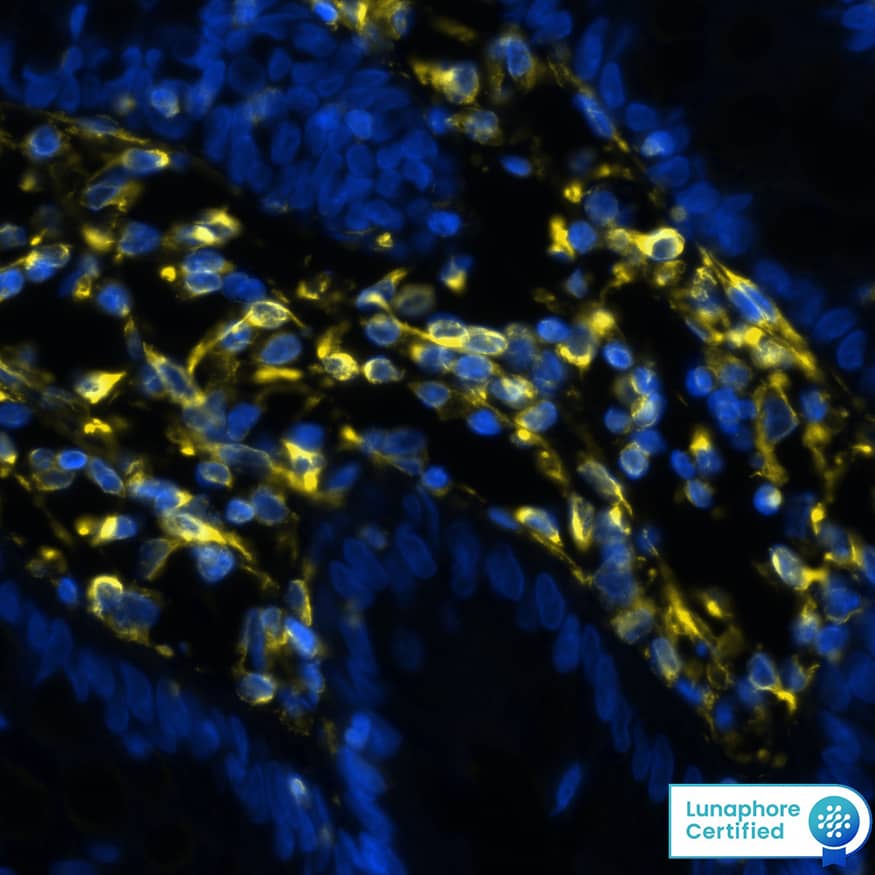 Vimentin was detected in immersion fixed paraffin-embedded sections of human colon using Rat Anti-Human/Mouse/Rat Vimentin Monoclonal Antibody (Catalog # MAB2105) at 1 µg/mL at 37 ° Celsius for 4 minutes. Before incubation with the primary antibody, tissue underwent an all-in-one dewaxing and antigen retrieval preprocessing using PreTreatment Module (PT Module) and Dewax and HIER Buffer H (pH 9). Tissue was stained using the Alexa Fluor™ Plus 647 Goat anti-Rat IgG Secondary Antibody at 1:200 at 37 ° Celsius for 2 minutes. (Yellow; Lunaphore Catalog # DR647RT) and counterstained with DAPI (blue; Lunaphore Catalog # DR100). Specific staining was localized to the cytoplasm and cytoskeleton. Protocol available in COMET™ Panel Builder.