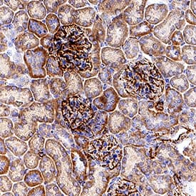 Vimentin was detected in immersion fixed paraffin-embedded sections of mouse kidney using Rat Anti-Human/Mouse/Rat Vimentin Monoclonal Antibody (Catalog # MAB2105) at 5 µg/ml overnight at 4 °C. Before incubation with the primary antibody, tissue was subjected to heat-induced epitope retrieval using VisUCyte Antigen Retrieval Reagent-Basic (Catalog # VCTS021). Tissue was stained using the HRP-conjugated Anti-Rat IgG Secondary Antibody (Catalog # HAF005) and counterstained with hematoxylin (blue). Specific staining was localized to the cytoplasm. View our protocol for Chromogenic IHC Staining of Paraffin-embedded Tissue Sections.