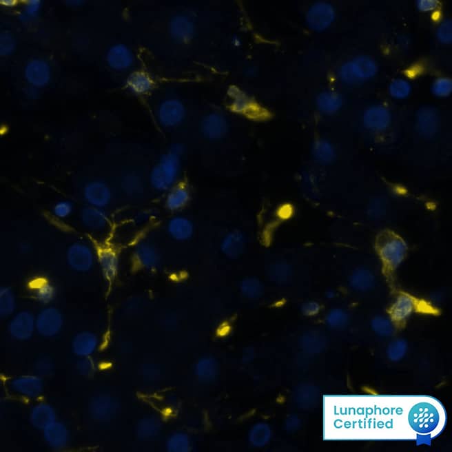 Vimentin was detected in immersion fixed paraffin-embedded sections of human liver using Rat Anti-Human/Mouse/Rat Vimentin Monoclonal Antibody (Catalog # MAB2105) at 1 µg/mL at 37 ° Celsius for 4 minutes. Before incubation with the primary antibody, tissue underwent an all-in-one dewaxing and antigen retrieval preprocessing using PreTreatment Module (PT Module) and Dewax and HIER Buffer H (pH 9; Epredia Catalog # TA-999-DHBH). Tissue was stained using the Alexa Fluor™ 647 Goat anti-Rat IgG Secondary Antibody at 1:200 at 37 ° Celsius for 2 minutes. (Yellow; Lunaphore Catalog # DR647RT) and counterstained with DAPI (blue; Lunaphore Catalog # DR100). Specific staining was localized to the cytoplasm and cytoskeleton. Protocol available in COMET™ Panel Builder.​