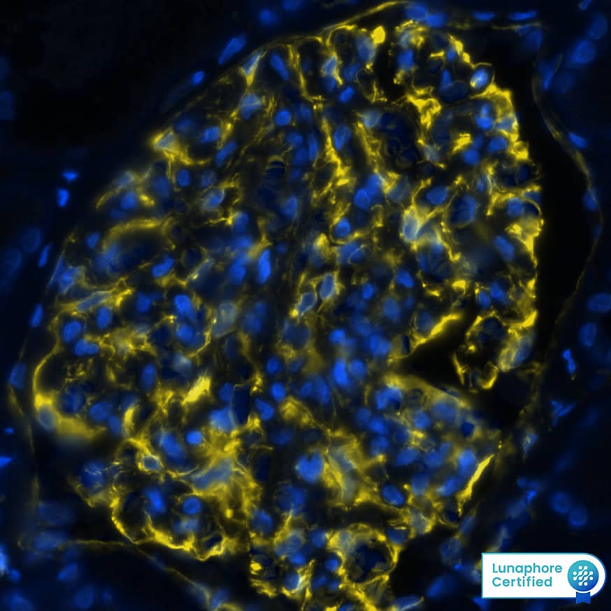 Vimentin was detected in immersion fixed paraffin-embedded sections of human kidney using Rat Anti-Human/Mouse/Rat Vimentin Monoclonal Antibody (Catalog # MAB2105) at 1 µg/mL at 37 ° Celsius for 4 minutes. Before incubation with the primary antibody, tissue underwent an all-in-one dewaxing and antigen retrieval preprocessing using PreTreatment Module (PT Module) and Dewax and HIER Buffer H (pH 9; Epredia Catalog # TA-999-DHBH). Tissue was stained using the Alexa Fluor™ 647 Goat anti-Rat IgG Secondary Antibody at 1:200 at 37 ° Celsius for 2 minutes. (Yellow; Lunaphore Catalog # DR647RT) and counterstained with DAPI (blue; Lunaphore Catalog # DR100). Specific staining was localized to the cytoplasm and cytoskeleton. Protocol available in COMET™ Panel Builder.​​