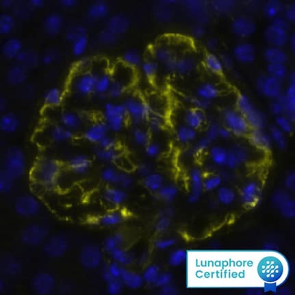 Vimentin Antibody was detected in immersion fixed paraffin-embedded sections of Mouse Kidney using Rat Anti-Mouse Vimentin, Monoclonal Antibody (Catalog # MAB2105) at 10ug/mL at 37 ° Celsius for 4 minutes. Before incubation with the primary antibody, tissue underwent an all-in-one dewaxing and antigen retrieval preprocessing using PreTreatment Module (PT Module) and Dewax and HIER Buffer H (pH 9; Epredia Catalog # TA-999-DHBH). Tissue was stained using the Alexa Fluor™ 647 Goat anti-Rat IgG Secondary Antibody at 1:200 at 37 ° Celsius for 2 minutes. (Yellow; Lunaphore Catalog # DR647RT) and counterstained with DAPI (blue; Lunaphore Catalog # DR100). Specific staining was localized to the membrane. Protocol available in COMET™ Panel Builder.