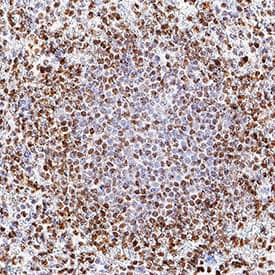 CHL‑1/L1CAM‑2 was detected in immersion fixed paraffin-embedded sections of human spleen using Rat Anti-Human CHL‑1/L1CAM‑2 Monoclonal Antibody (Catalog # MAB2126) at 1.7 µg/mL for 1 hour at room temperature followed by incubation with the Anti-Rat IgG VisUCyte™ HRP Polymer Antibody (VC005). Before incubation with the primary antibody, tissue was subjected to heat-induced epitope retrieval using Antigen Retrieval Reagent-Basic (CTS013). Tissue was stained using DAB (brown) and counterstained with hematoxylin (blue). Specific staining was localized to cell nuclei. Staining was performed using our protocol for IHC Staining with VisUCyte HRP Polymer Detection Reagents.