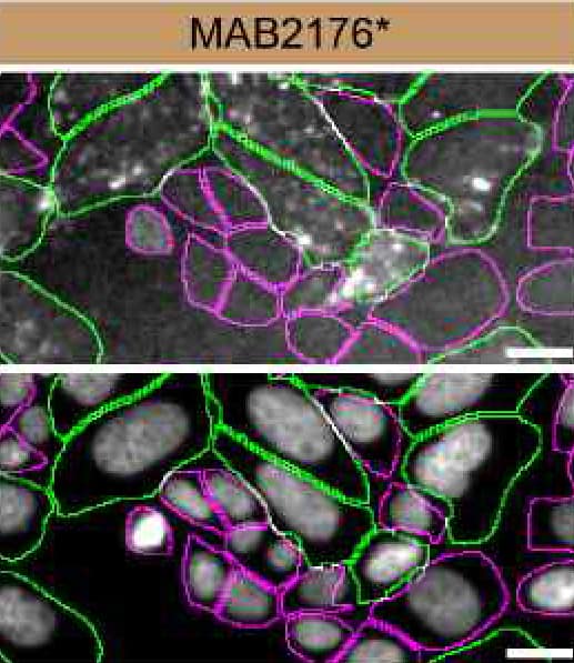 HAP1 parental cell line WT and Cathepsin B HAP1 KO cells were labelled with a green or a far-red fluorescent dye, respectively. Cells were stained with Mouse Anti-Human Pro Cathepsin B Monoclonal Antibody (Catalog # MAB2176) followed by incubation with an Alexa-fluor 555 conjugated secondary antibody (upper panel). DAPI-only counterstained cells shown on a lower panel. Acquisition of the blue (nucleus-DAPI), green (identification of WT cells), red (antibody staining) and far-red (identification of KO cells) channels was performed. Representative images of the blue and red (grayscale) channels are shown. WT and KO cells are outlined with green and magenta dashed line, respectively. Primary antibody dilution used: 1 µg/mL. Image, protocol and testing courtesy of YCharOS Inc. (ycharos.com).
