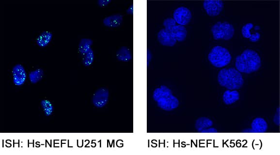 NF-L mRNA was detected in formalin-fixed U-251 MG human glioblastoma cell line probed with ACD RNAScope®Probe-Hs-NEFL  (Catalog # 468671) and stained using ACD RNAscope®2.5 HD Detection Reagents-RED (Catalog # 32260). This is an In Situ Hybridization control for NF-L expression.
