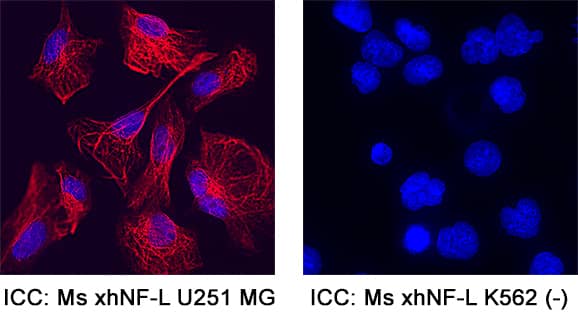 NF‑L was detected in immersion fixed U‑251 MG human glioblastoma cell line (positive staining) and K562 human chronic myelogenous leukemia cell line (negative staining) using Mouse Anti-Human NF‑L Monoclonal Antibody (Catalog # MAB22162) at 8 &micro;g/mL for 3 hours at room temperature. Cells were stained using the NorthernLights&trade; 557-conjugated Anti-Mouse IgG Secondary Antibody (red; NL007) and counterstained with DAPI (blue). Specific staining was localized to cytoplasm. Staining was performed using our protocol for Fluorescent ICC Staining of Non-adherent Cells.