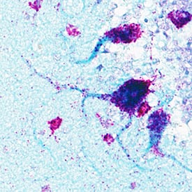 <b>Orthogonal Strategies Validation. </b>NEFL mRNA (red) and protein (green/blue) was detected in formalin-fixed paraffin-embedded tissue sections of Human Cerebellum. ACD’s Integrated Co-Detection Workflow was performed using ACD RNAScope Probe Hs-NEFL (Catalog # 468671) and Mouse Anti-Human NEFL Monoclonal Antibody (R&D Systems, Catalog # MAB22164) at 7ug/mL. Tissue was stained using RNAscope® 2.5 HD Detection Reagents-RED (Catalog # 322360), Mouse IgG VisUCyte HRP Polymer Antibody (VC001) and RNAscope® 2.5 LS Green Accessory Pack (Catalog #322550). Tissue was counterstained with 50% hematoxylin (purple).