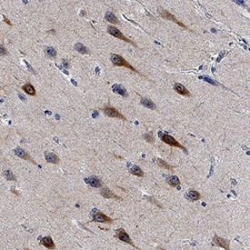 NF‑L was detected in immersion fixed paraffin-embedded sections of Human Hippocampus using Mouse Anti-Human NF‑L Monoclonal Antibody (Catalog # MAB22165) at 1.7 µg/mL for 1 hour at room temperature followed by incubation with the Anti-Mouse IgG VisUCyte™ HRP Polymer Antibody (Catalog # VC001). Before incubation with the primary antibody, tissue was subjected to heat-induced epitope retrieval using VisUCyte Antigen Retrieval Reagent-Basic (Catalog # VCTS021). Tissue was stained using DAB (brown) and counterstained with hematoxylin (blue). Specific staining was localized to neuronal cell bodies and processes. View our protocol for IHC Staining with VisUCyte HRP Polymer Detection Reagents.