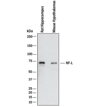 Western blot shows lysates of mouse brain (hypothalamus) and rat brain (hippocampus). PVDF membrane was probed with 1 µg/mL of Mouse Anti-Human/Mouse/Rat NF‑L Monoclonal Antibody (Catalog # MAB2216) followed by HRP-conjugated Anti-Mouse IgG Secondary Antibody (HAF018) . A specific band was detected for NF‑L at approximately 74 kDa (as indicated). This experiment was conducted under reducing conditions and using Western Blot Buffer Group 1.