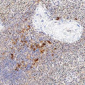 LAG‑3 was detected in immersion fixed paraffin-embedded sections of human spleen using Mouse Anti-Human LAG‑3 Monoclonal Antibody (Catalog # MAB23196) at 5 &micro;g/mL for 1 hour at room temperature followed by incubation with the Anti-Mouse IgG VisUCyte&trade; HRP Polymer Antibody (VC001). Before incubation with the primary antibody, tissue was subjected to heat-induced epitope retrieval using Antigen Retrieval Reagent-Basic (CTS013). Tissue was stained using DAB (brown) and counterstained with hematoxylin (blue). Specific staining was localized to lymphocytes. Staining was performed using our protocol for IHC Staining with VisUCyte HRP Polymer Detection Reagents.