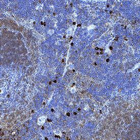 LAG‑3 was detected in immersion fixed paraffin-embedded sections of mouse spleen using Mouse Anti-Human LAG‑3 Monoclonal Antibody (Catalog # MAB23196) at 15 &micro;g/mL for 1 hour at room temperature followed by incubation with the Anti-Mouse IgG VisUCyte&trade; HRP Polymer Antibody (VC001). Before incubation with the primary antibody, tissue was subjected to heat-induced epitope retrieval using Antigen Retrieval Reagent-Basic (CTS013). Tissue was stained using DAB (brown) and counterstained with hematoxylin (blue). Specific staining was localized to lymphocytes. Staining was performed our protocol for IHC Staining with VisUCyte HRP Polymer Detection Reagents.