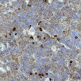 LAG‑3 was detected in immersion fixed paraffin-embedded sections of mouse spleen using Mouse Anti-Human LAG‑3 Monoclonal Antibody (Catalog # MAB23197) at 15 &micro;g/mL for 1 hour at room temperature followed by incubation with the Anti-Mouse IgG VisUCyte&trade; HRP Polymer Antibody (VC001). Before incubation with the primary antibody, tissue was subjected to heat-induced epitope retrieval using Antigen Retrieval Reagent-Basic (CTS013). Tissue was stained using DAB (brown) and counterstained with hematoxylin (blue). Specific staining was localized to lymphocytes. Staining was performed using our protocol for IHC Staining with VisUCyte HRP Polymer Detection Reagents.