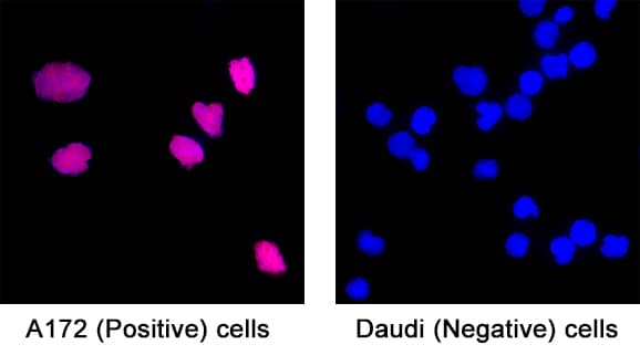 FGF basic/FGF2/bFGF was detected in immersion fixed A172 human glioblastoma cells (positive) and absent in Daudi human Burkitt's lymphoma cells (negative) using Mouse Anti-Human FGF basic/FGF2/bFGF Monoclonal Antibody (Catalog # MAB2333) at 8 µg/mL for 3 hours at room temperature. Cells were stained using the NorthernLights™ 557-conjugated Anti-Rat IgG Secondary Antibody (red; Catalog # NL013) and counterstained with DAPI (blue). Specific staining was localized to cytoplasm. View our protocol for Fluorescent ICC Staining of Cells on Coverslips.