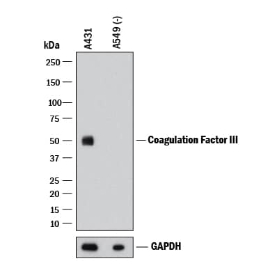 <b>Biological Strategies Validation. </b>Western blot shows lysates of A431 human epithelial carcinoma cell line and A549 human lung carcinoma cell line (negative control). PVDF membrane was probed with 1 µg/mL of Mouse Anti-Human Coagulation Factor III/Tissue Factor Monoclonal Antibody (Catalog # MAB2339) followed by HRP-conjugated Anti-Mouse IgG Secondary Antibody (HAF018). A specific band was detected for Coagulation Factor III/Tissue Factor at approximately 48 kDa (as indicated). GAPDH (MAB5718) is shown as a loading control. This experiment was conducted under reducing conditions and using Western Blot Buffer Group 1.