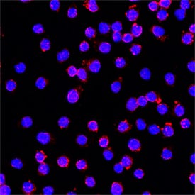 S100A10 was detected in immersion fixed TK‑1 mouse T cell lymphoma cell line using Rat Anti-Mouse S100A10 Monoclonal Antibody (Catalog # MAB2377) at 5 &micro;g/mL for 3 hours at room temperature. Cells were stained using the NorthernLights&trade; 557-conjugated Anti-Rat IgG Secondary Antibody (red; NL013) and counterstained with DAPI (blue). Specific staining was localized to cytoplasm. Staining was performed using our protocol for Fluorescent ICC Staining of Non-adherent Cells.