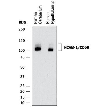 Western blot shows lysates of human brain (cerebellum and hypothalamus). PVDF membrane was probed with 2 µg/mL of Mouse Anti-Human NCAM‑1/CD56 Monoclonal Antibody (Catalog # MAB24081) followed by HRP-conjugated Anti-Mouse IgG Secondary Antibody (HAF018). A specific band was detected for NCAM‑1/CD56 at approximately 105-130 kDa (as indicated). This experiment was conducted under reducing conditions and using Western Blot Buffer Group 1.