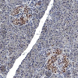 PDX‑1/IPF1 was detected in immersion fixed paraffin-embedded sections of human pancreas using Mouse Anti-Human/Mouse PDX‑1/IPF1 Monoclonal Antibody (Catalog # MAB2419) at 5 µg/ml for 1 hour at room temperature followed by incubation with the Anti-Mouse IgG VisUCyte™ HRP Polymer Antibody (Catalog # VC001). Before incubation with the primary antibody, tissue was subjected to heat-induced epitope retrieval using VisUCyte Antigen Retrieval Reagent-Basic (Catalog # VCTS021). Tissue was stained using DAB (brown) and counterstained with hematoxylin (blue). Specific staining was localized to the nucleus in islet cells. View our protocol for IHC Staining with VisUCyte HRP Polymer Detection Reagents.