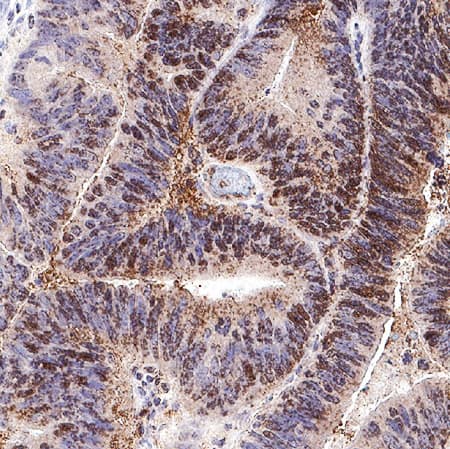 Immunohistochemistry CXCL5/ENA-78 Antibody (33160) [Unconjugated]