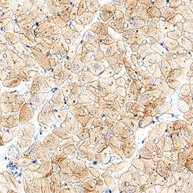 Nidogen‑1/Entactin was detected in immersion fixed paraffin-embedded sections of human heart using Mouse Anti-Human Nidogen‑1/Entactin Monoclonal Antibody (Catalog # MAB2570) at 5 µg/ml for 1 hour at room temperature followed by incubation with the HRP-conjugated Anti-Mouse IgG Secondary Antibody (Catalog # HAF007) or the Anti-Mouse IgG VisUCyte™ HRP Polymer Antibody (Catalog # VC001). Before incubation with the primary antibody, tissue was subjected to heat-induced epitope retrieval using VisUCyte Antigen Retrieval Reagent-Basic (Catalog # VCTS021). Tissue was stained using DAB (brown) and counterstained with hematoxylin (blue). Specific staining was localized to the membrane. View our protocol for Chromogenic IHC Staining of Paraffin-embedded Tissue Sections.