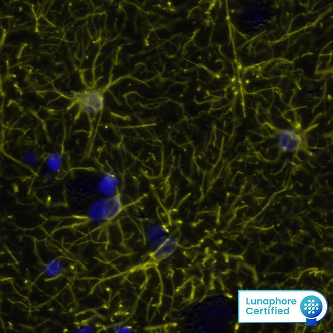 GFAP Antibody was detected in immersion fixed paraffin-embedded sections of human Brain Cortex using Mouse Anti-Human GFAP Monoclonal Antibody (Catalog # MAB25941) at 0.25ug/mL at 37 ° Celsius for 4 minutes. Before incubation with the primary antibody, tissue underwent an all-in-one dewaxing and antigen retrieval preprocessing using PreTreatment Module (PT Module) and Dewax and HIER Buffer H (pH 9; Epredia Catalog # TA-999-DHBH). Tissue was stained using the Alexa Fluor™ 555 Goat anti-Mouse IgG Secondary Antibody at 1:100 at 37 ° Celsius for 2 minutes. (Yellow; Lunaphore Catalog # DR555MS) and counterstained with DAPI (blue; Lunaphore Catalog # DR100). Specific staining was localized to the cytoplasm. Protocol available in COMET™ Panel Builder.​​