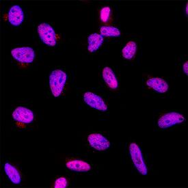 Immunocytochemistry CBP/KAT3A Antibody (257003) [Unconjugated]