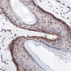 Immunohistochemistry Cadherin-13 Antibody (392411) [Unconjugated]