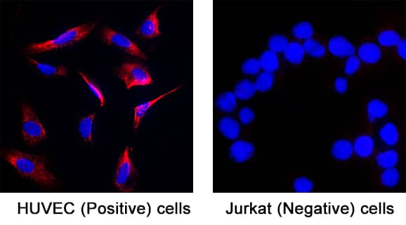 Endothelin‑1 was detected in immersion fixed HUVEC human umbilical vein endothelial cells (positive) and absent in Jurkat human acute T cell leukemia cells (negative) using Mouse Anti-Human Endothelin‑1 Monoclonal Antibody (Catalog # MAB34402) at 8 µg/mL for 3 hours at room temperature. Cells were stained using the NorthernLights™ 557-conjugated Anti-Mouse IgG Secondary Antibody (red; Catalog # NL007) and counterstained with DAPI (blue). Specific staining was localized to cell cytoplasm. View our protocol for Fluorescent ICC Staining of Cells on Coverslips.