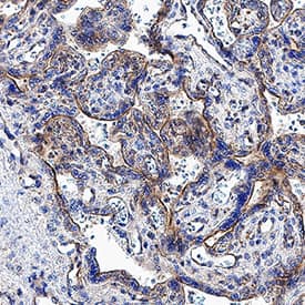 Frizzled‑10 was detected in immersion fixed paraffin-embedded sections of human placenta tissue using Mouse Anti-Human Frizzled‑10 Monoclonal Antibody (Catalog # MAB3458) at 5 µg/mL for 1 hour at room temperature followed by incubation with the Anti-Mouse IgG VisUCyte™ HRP Polymer Antibody (VC001). Before incubation with the primary antibody, tissue was subjected to heat-induced epitope retrieval using Antigen Retrieval Reagent-Basic (CTS013). Tissue was stained using DAB (brown) and counterstained with hematoxylin (blue). Specific staining was localized to cytoplasm in syncytiotrophoblast. Staining was performed using our IHC Staining with VisUCyte HRP Polymer Detection Reagents protocol.