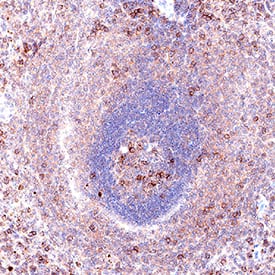 Integrin  alpha L/CD11a was detected in immersion fixed paraffin-embedded sections of Human Spleen using Mouse Anti-Human Integrin  alpha L/CD11a Monoclonal Antibody (Catalog # MAB35952) at 5 µg/mL for 1 hour at room temperature followed by incubation with the Anti-Mouse IgG VisUCyte™ HRP Polymer Antibody (Catalog # VC001). Before incubation with the primary antibody, tissue was subjected to heat-induced epitope retrieval using VisUCyte Antigen Retrieval Reagent-Basic (Catalog # VCTS021). Tissue was stained using DAB (brown) and counterstained with hematoxylin (blue). Specific staining was localized to lymphocytes. View our protocol for IHC Staining with VisUCyte HRP Polymer Detection Reagents.