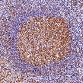 TLR9 was detected in immersion fixed paraffin-embedded sections of human tonsil using Mouse Anti-Human/Mouse TLR9 Monoclonal Antibody (Catalog # MAB36581) at 5 µg/ml for 1 hour at room temperature followed by incubation with the Anti-Mouse IgG VisUCyte™ HRP Polymer Antibody (Catalog # VC001). Before incubation with the primary antibody, tissue was subjected to heat-induced epitope retrieval using VisUCyte Antigen Retrieval Reagent-Basic (Catalog # VCTS021). Tissue was stained using DAB (brown) and counterstained with hematoxylin (blue). Specific staining was localized to the cytoplasm. View our protocol for IHC Staining with VisUCyte HRP Polymer Detection Reagents.