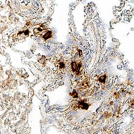 Immunohistochemistry Tryptase beta-2/TPSB2 Antibody (349406) [Unconjugated]