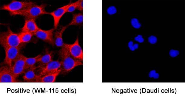 Immunocytochemistry IGSF4C/SynCAM4 Antibody (404619) [Unconjugated]