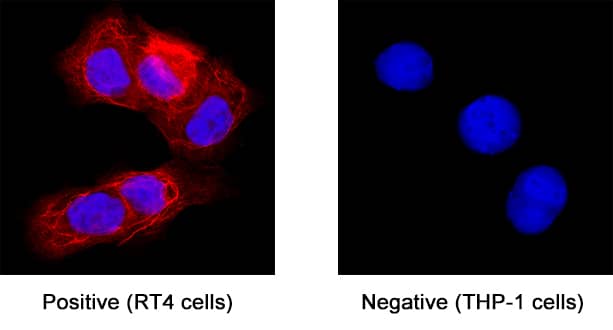CXCL17/VCC‑1 was detected in immersion fixed RT‑4 human urinary bladder transitional cell papilloma cell line (positive staining) and THP‑1 human acute monocytic leukemia cell line (negative staining) using Mouse Anti-Human CXCL17/VCC‑1 Monoclonal Antibody (Catalog # MAB42071) at 8 µg/mL for 3 hours at room temperature. Cells were stained using the NorthernLights™ 557-conjugated Anti-Mouse IgG Secondary Antibody (red; NL007) and counterstained with DAPI (blue). Specific staining was localized to cell surface and cytoplasm. Staining was performed using our protocol for Fluorescent ICC Staining of Non-adherent Cells.