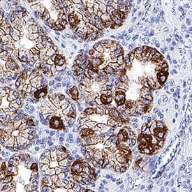 CXCL17/VCC‑1 was detected in immersion fixed paraffin-embedded sections of human stomach using Mouse Anti-Human CXCL17/VCC‑1 Monoclonal Antibody (Catalog # MAB42071) at 5 µg/mL for 1 hour at room temperature followed by incubation with the Anti-Mouse IgG VisUCyte™ HRP Polymer Antibody (VC001). Before incubation with the primary antibody, tissue was subjected to heat-induced epitope retrieval using Antigen Retrieval Reagent-Basic (CTS013). Tissue was stained using DAB (brown) and counterstained with hematoxylin (blue). Specific staining was localized to cell surface and cytoplasm in gastric glands. Staining was performed using our protocol for IHC Staining with VisUCyte HRP Polymer Detection Reagents.