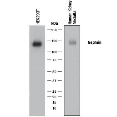 Western blot shows lysates of HEK293T human embryonic kidney cell line and human kidney (medulla). PVDF membrane was probed with 1 µg/mL of Mouse Anti-Human Nephrin Monoclonal Antibody (Catalog # MAB42692) followed by HRP-conjugated Anti-Mouse IgG Secondary Antibody (HAF018). A specific band was detected for Nephrin at approximately 134 kDa (as indicated). This experiment was conducted under reducing conditions and using Western Blot Buffer Group 1.