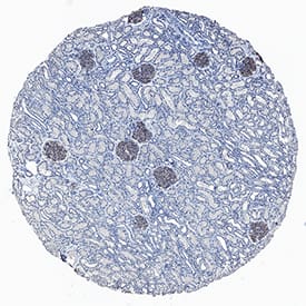 Nephrin was detected in immersion fixed paraffin-embedded sections of human kidney using Rabbit Anti-Human Nephrin Monoclonal Antibody (Catalog # MAB42693) at 3 µg/mL for 1 hour at room temperature followed by incubation with the Anti-Rabbit IgG VisUCyte™ HRP Polymer Antibody (VC003). Before incubation with the primary antibody, tissue was subjected to heat-induced epitope retrieval using Antigen Retrieval Reagent-Basic (CTS013). Tissue was stained using DAB (brown) and counterstained with hematoxylin (blue). Specific staining was localized to glomeruli. Staining was performed using our protocol for IHC Staining with VisUCyte HRP Polymer Detection Reagents.