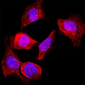 Numb was detected in immersion fixed RT‑4 human urinary bladder transitional cell papilloma cell line using Mouse Anti-Human Numb Monoclonal Antibody (Catalog # MAB4338) at 8 &micro;g/mL for 3 hours at room temperature. Cells were stained using the NorthernLights&trade; 557-conjugated Anti-Mouse IgG Secondary Antibody (red; NL007) and counterstained with DAPI (blue). Specific staining was localized to cytoplasm. Staining was performed using our protocol for Fluorescent ICC Staining of Non-adherent Cells.
