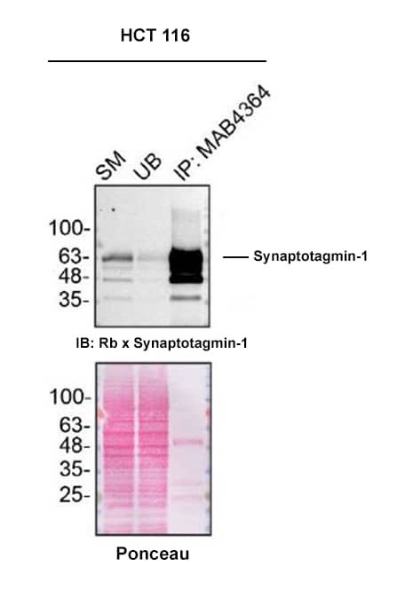 HCT 116 lysates were prepared and immunoprecipitation was performed using 2.0 µg of Mouse Anti-Rat Synaptotagmin-1 Monoclonal Antibody (Catalog # MAB4364) pre-coupled to Dynabeads protein G. Immunoprecipitated Synaptotagmin-1 was detected with a Rabbit Anti-Synaptotagmin-1 antibody. The Ponceau stained transfer of the blot is shown. SM=4% starting material; UB=4% unbound fraction; IP=immunoprecipitate; HC=antibody heavy chain. Image, protocol and testing courtesy of YCharOS Inc. (ycharos.com).