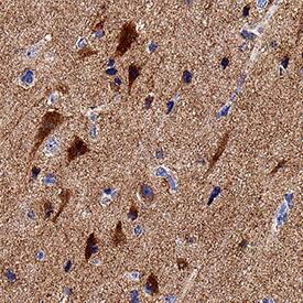 Neuronal Pentraxin R/NPTXR was detected in immersion fixed paraffin-embedded sections of human brain (cortex) using Mouse Anti-Human/Mouse Neuronal Pentraxin R/NPTXR Monoclonal Antibody (Catalog # MAB4414) at 5 µg/mL for 1 hour at room temperature followed by incubation with the Anti-Mouse IgG VisUCyte™ HRP Polymer Antibody (VC001). Before incubation with the primary antibody, tissue was subjected to heat-induced epitope retrieval using Antigen Retrieval Reagent-Basic (CTS013). Tissue was stained using DAB (brown) and counterstained with hematoxylin (blue). Specific staining was localized to neuronal cell bodies and processes. Staining was performed using our protocol for IHC Staining with VisUCyte HRP Polymer Detection Reagents.