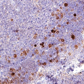 CXCL10/IP-10/CRG-2 was detected in immersion fixed paraffin-embedded sections of Mouse Thymus using Rat Anti-Mouse CXCL10/IP-10/CRG-2 Monoclonal Antibody (Catalog # MAB4661) at 15 µg/mL for 1 hour at room temperature followed by incubation with the Anti-Rat IgG VisUCyte™ HRP Polymer Antibody (VCTS005). Before incubation with the primary antibody, tissue was subjected to heat-induced epitope retrieval using VisUCyte Antigen Retrieval Reagent-Basic (VCTS022). Tissue was stained using DAB (brown) and counterstained with hematoxylin (blue). Specific staining was localized to lymphocytes. View our protocol for Chromogenic IHC Staining of Paraffin-embedded Tissue Sections.