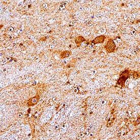 mGluR3 was detected in immersion fixed paraffin-embedded sections of human hypothalamus tissue using Mouse Anti-Human mGluR3 Monoclonal Antibody (Catalog # MAB4668) at 5 &micro;g/mL for 1 hour at room temperature followed by incubation with the Anti-Mouse IgG VisUCyte&trade; HRP Polymer Antibody (VC001). Before incubation with the primary antibody, tissue was subjected to heat-induced epitope retrieval using Antigen Retrieval Reagent-Basic (CTS013). Tissue was stained using DAB (brown) and counterstained with hematoxylin (blue). Specific staining was localized to cell membrane in neurons. Staining was performed using our IHC Staining with VisUCyte HRP Polymer Detection Reagents protocol.