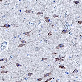 mGluR1 was detected in immersion fixed paraffin-embedded sections of Human Hippocampus using Mouse Anti-Human mGluR1 Monoclonal Antibody (Catalog # MAB48362) at 5 µg/mL for 1 hour at room temperature followed by incubation with the Anti-Mouse IgG VisUCyte™ HRP Polymer Antibody (Catalog # VC001). Before incubation with the primary antibody, tissue was subjected to heat-induced epitope retrieval using VisUCyte Antigen Retrieval Reagent-Basic (Catalog # VCTS021). Tissue was stained using DAB (brown) and counterstained with hematoxylin (blue). Specific staining was localized to plasma membrane and cytoplasm in neurons. View our protocol for IHC Staining with VisUCyte HRP Polymer Detection Reagents.