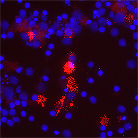 IL‑1 beta /IL‑1F2 was detected in Immersion fixed Rat Splenocytes cells using Mouse Anti-Rat IL‑1 beta /IL‑1F2 Monoclonal Antibody (Catalog # MAB501) at 10 µg/ml for 3 hours at room temperature. Cells were stained using the NorthernLights™ 557-conjugated Anti-Mouse IgG Secondary Antibody (red; Catalog # NL007) and counterstained with DAPI (blue). Specific staining was localized to the cytoplasm. View our protocol for Fluorescent ICC Staining of Cells on Coverslips.