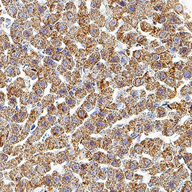 IL‑1 beta /IL‑1F2 was detected in perfusion fixed paraffin-embedded sections of rat liver using Mouse Anti-Rat IL‑1 beta /IL‑1F2 Monoclonal Antibody (Catalog # MAB501) at 15 µg/ml overnight at 4 °C. Before incubation with the primary antibody, tissue was subjected to heat-induced epitope retrieval using VisUCyte Antigen Retrieval Reagent-Basic (Catalog # VCTS021). Tissue was stained using the HRP-conjugated Anti-Mouse IgG Secondary Antibody (Catalog # HAF007) and counterstained with hematoxylin (blue). Specific staining was localized to the cytoplasm. View our protocol for Chromogenic IHC Staining of Paraffin-embedded Tissue Sections.