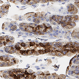 IL‑1 beta /IL‑1F2 was detected in perfusion fixed paraffin-embedded sections of rat stomach using Mouse Anti-Rat IL‑1 beta /IL‑1F2 Monoclonal Antibody (Catalog # MAB501) at 15 µg/ml overnight at 4 °C. Before incubation with the primary antibody, tissue was subjected to heat-induced epitope retrieval using VisUCyte Antigen Retrieval Reagent-Basic (Catalog # VCTS021). Tissue was stained using the HRP-conjugated Anti-Mouse IgG Secondary Antibody (Catalog # HAF007) and counterstained with hematoxylin (blue). Specific staining was localized to the cytoplasm. View our protocol for Chromogenic IHC Staining of Paraffin-embedded Tissue Sections.