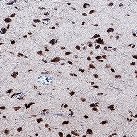 Enolase 2/Neuron‑specific Enolase was detected in immersion fixed paraffin-embedded sections of human brain (cortex) using Mouse Anti-Human Enolase 2/Neuron‑specific Enolase Monoclonal Antibody (Catalog # MAB5169) at 15 &micro;g/mL for 1 hour at room temperature followed by incubation with the Anti-Mouse IgG VisUCyte&trade; HRP Polymer Antibody (VC001). Before incubation with the primary antibody, tissue was subjected to heat-induced epitope retrieval using Antigen Retrieval Reagent-Basic (CTS013). Tissue was stained using DAB (brown) and counterstained with hematoxylin (blue). Specific staining was localized to cytoplasm in neurons. Staining was performed using our protocol for IHC Staining with VisUCyte HRP Polymer Detection Reagents.
