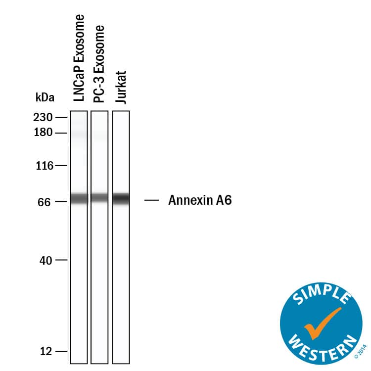 Simple Western shows lysates of Exosome Standards (LNCaP) (NBP3-11687), Exosome Standards (PC‑3) (NBP2-49856) and Jurkat human acute T cell leukemia cell line, loaded at 0.5 mg/ml. A specific band was detected for Annexin A6 at approximately 72 kDa (as indicated) using 1 µg/mL of Mouse Anti-Human Annexin A6 Monoclonal Antibody (Catalog # MAB5186). This experiment was conducted under reducing conditions and using the 12-230kDa separation system.