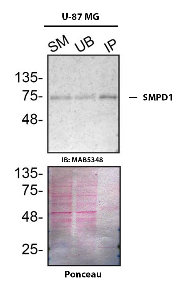 Immunoprecipitation SMPD1 Antibody (563418) [Unconjugated]